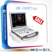 DW-C60 economical color doppler ultrasound & laptop color doppler